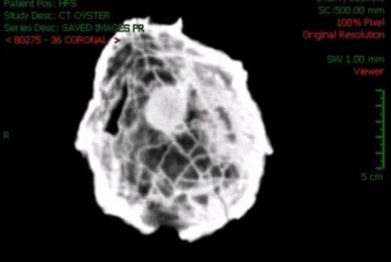 内部有个圆状物体：核磁共振成像扫描显示的这个位于巨大牡蛎内部的神秘圆状物体很可能是颗大珍珠。